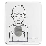 Infant/Child Pads Placement Guide